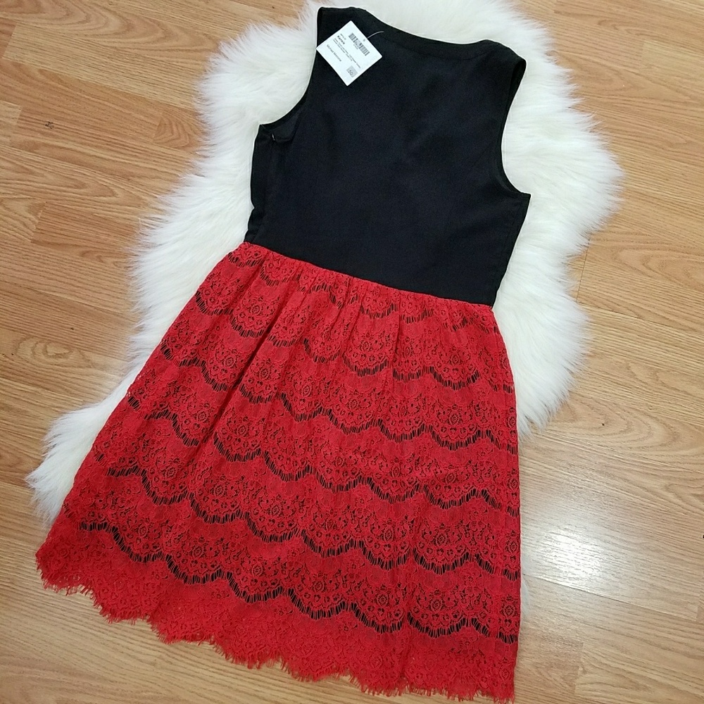 NWT Kensie Black & Red Lace Trim Dress w Buttons - Picture 5 of 7